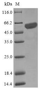 Recombinant Escherichia coli O6:K15:H31 Cysteine desulfurase IscS (iscS)