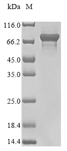 Recombinant Escherichia coli Polyphosphate kinase(ppk)