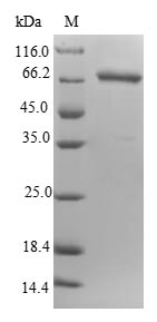 Recombinant Escherichia coli Putative binding protein ygiS(ygiS)