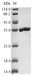 Recombinant Escherichia coli Uncharacterized protein YncE(yncE)