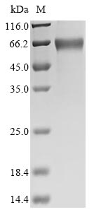 Recombinant Horse Erythropoietin(EPO)