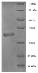 Recombinant Horse Myelin P2 protein(PMP2)