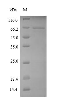 Recombinant Human  Elongation factor 1-alpha 1(EEF1A1)