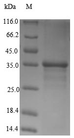 Recombinant Human  Transcription activator BRG1(SMARCA4),partial