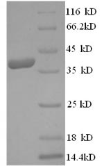 Recombinant Human 3-hydroxy-3-methylglutaryl-coenzyme A reductase(HMGCR),partial
