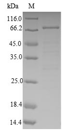 Recombinant Human 4-aminobutyrate aminotransferase, mitochondrial(ABAT)