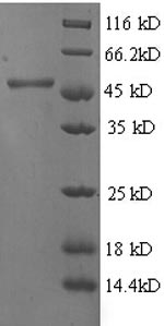 Recombinant Human 4-hydroxyphenylpyruvate dioxygenase(HPD)