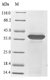 Recombinant Human 40S ribosomal protein SA(RPSA)