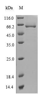 Recombinant Human 5'-nucleotidase(NT5E) (Active)