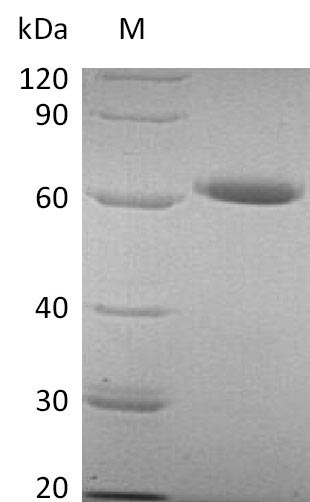 Recombinant Human 5'-nucleotidase(NT5E),partial (Active)