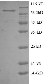 Recombinant Human 5'-nucleotidase(NT5E),partial