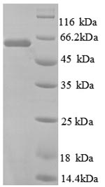 Recombinant Human 60 kDa SS-A/Ro ribonucleoprotein(RO60),partial