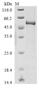 Recombinant Human AP-2 complex subunit mu(AP2M1)
