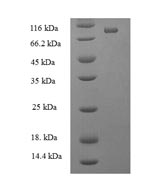 Recombinant Human ATP-dependent RNA helicase DDX19A(DDX19A)