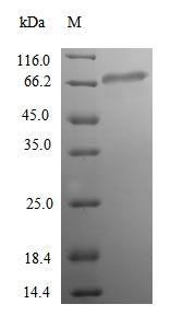 Recombinant Human Acetyl-coenzyme A synthetase 2-like, mitochondrial(ACSS1)