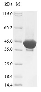 Recombinant Human Acetylserotonin O-methyltransferase(ASMT)