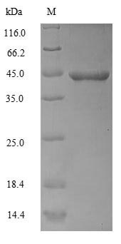 Recombinant Human Actin, alpha skeletal muscle(ACTA1) 