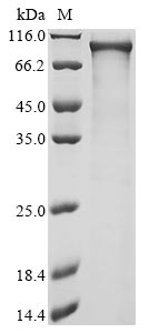 Recombinant Human Activating transcription factor 7-interacting protein 2(ATF7IP2)