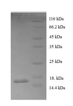 Recombinant Human Acyl-CoA-binding protein(DBI)