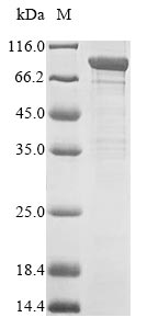 Recombinant Human Acylamino-acid-releasing enzyme(APEH)