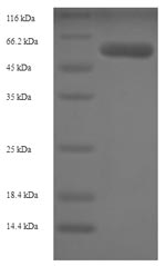 Recombinant Human Adenosylhomocysteinase(AHCY)