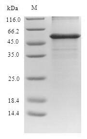 Recombinant Human Alanine aminotransferase 1(GPT)