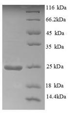 Recombinant Human Aldehyde oxidase(AOX1),partial