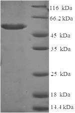 Recombinant Human Aldo-keto reductase family 1 member C2(AKR1C2)
