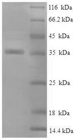 Recombinant Human Alpha-crystallin B chain(CRYAB)