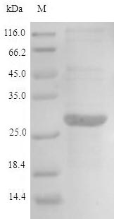 Recombinant Human Aminoacyl tRNA synthase complex-interacting multifunctional protein 2(AIMP2)