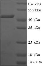 Recombinant Human Anamorsin(CIAPIN1)