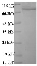 Recombinant Human Angiopoietin-related protein 4(ANGPTL4),partial
