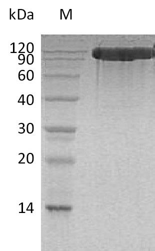 Recombinant Human Angiotensin-converting enzyme 2(ACE2),partial (Active)