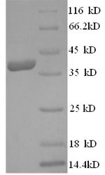 Recombinant Human Annexin A1(ANX1),partial
