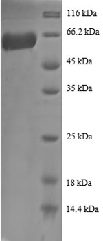 Recombinant Human Annexin A2(ANXA2)
