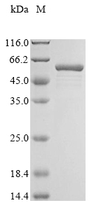 Recombinant Human Annexin A5(ANXA5)