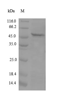 Recombinant Human Apolipoprotein M(APOM)