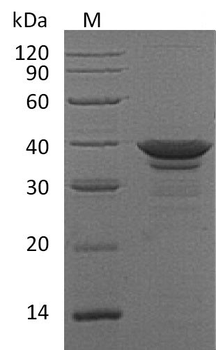 Recombinant Human Arginase-1(ARG1) (Active)
