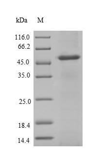 Recombinant Human Arylamine N-acetyltransferase 2(NAT2)