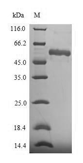Recombinant Human Asporin(ASPN)