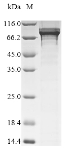 Recombinant Human B-cell lymphoma 6 protein(BCL6)