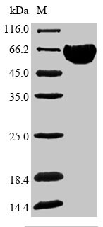 Recombinant Human Band 3 anion transport protein (SLC4A1),partial