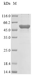 Recombinant Human Beta-hexosaminidase subunit beta(HEXB)