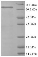 Recombinant Human Bifunctional heparan sulfate N-deacetylase/N-sulfotransferase 1(NDST1),partial