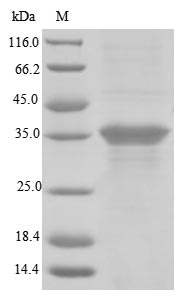 Recombinant Human Blood group Rh(D) polypeptide(RHD),partial