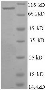 Recombinant Human Bone morphogenetic protein 1(BMP1) 