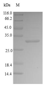 Recombinant Human Bone sialoprotein 2 (IBSP),partial