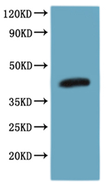 Recombinant Human C-C chemokine receptor type 8(CCR8)-VLPs (Active)