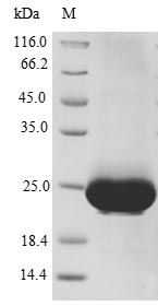 Recombinant Human C-X-C chemokine receptor type 4(CXCR4),partial