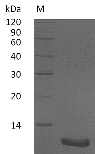 Recombinant Human C-X-C motif chemokine 2(CXCL2),partial (Active)